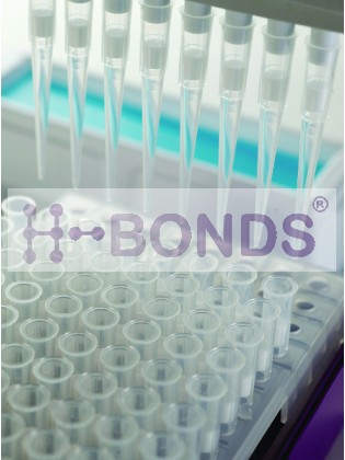 Filter tips, UltraFine™, extended, (0.1 - 10 μl) - (Sterile, Individually wrapped, 960/pk)