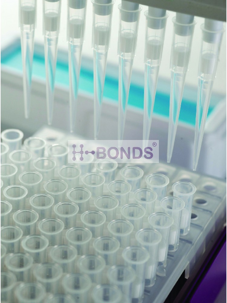 Filter tips, UltraFine™, extended, (0.1 - 10 μl) - (Sterile, Individually wrapped, 960/pk)